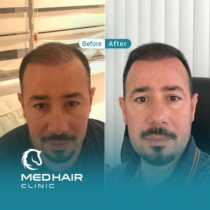 Images MedHair Clinic