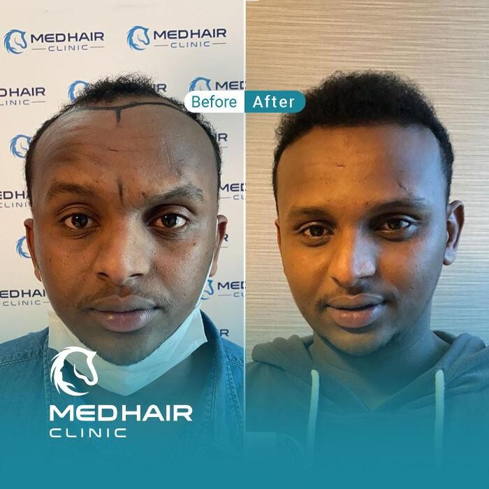 Images MedHair Clinic