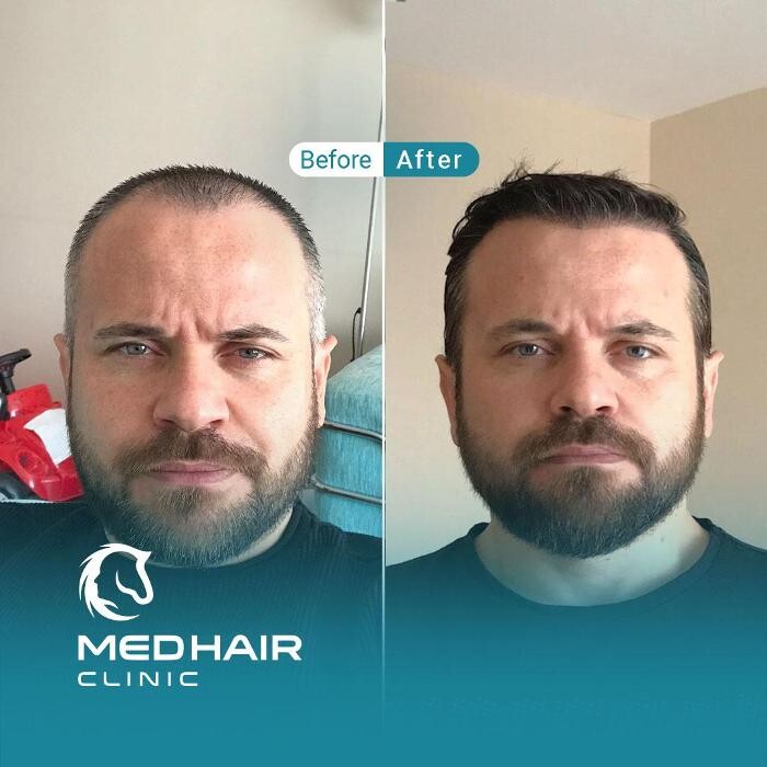 Images MedHair Clinic