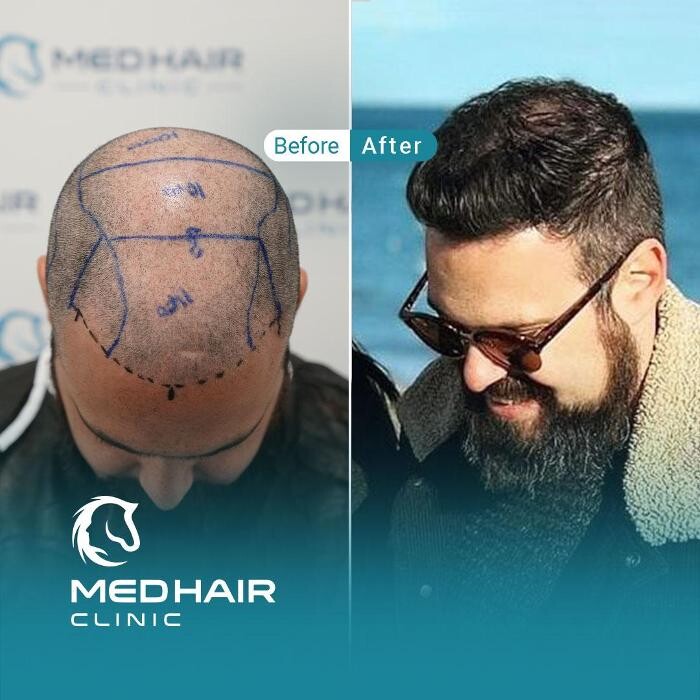 Images MedHair Clinic