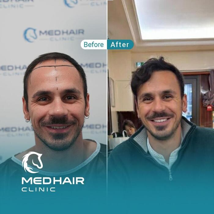 Images MedHair Clinic