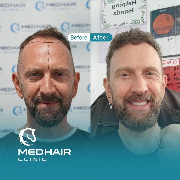 Images MedHair Clinic