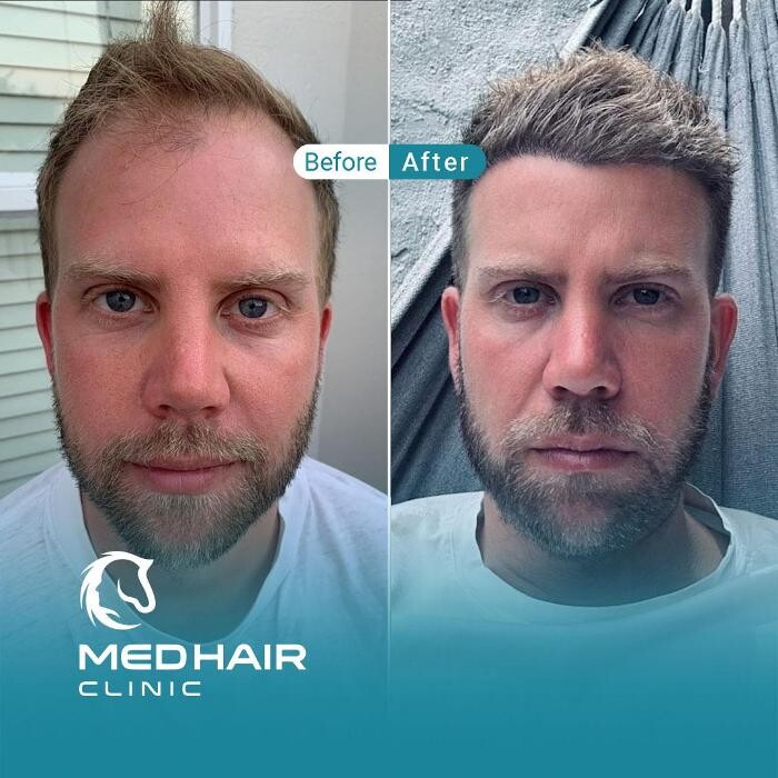 Images MedHair Clinic