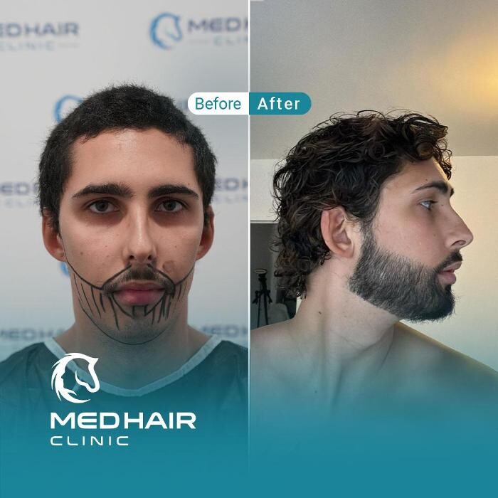 Images MedHair Clinic