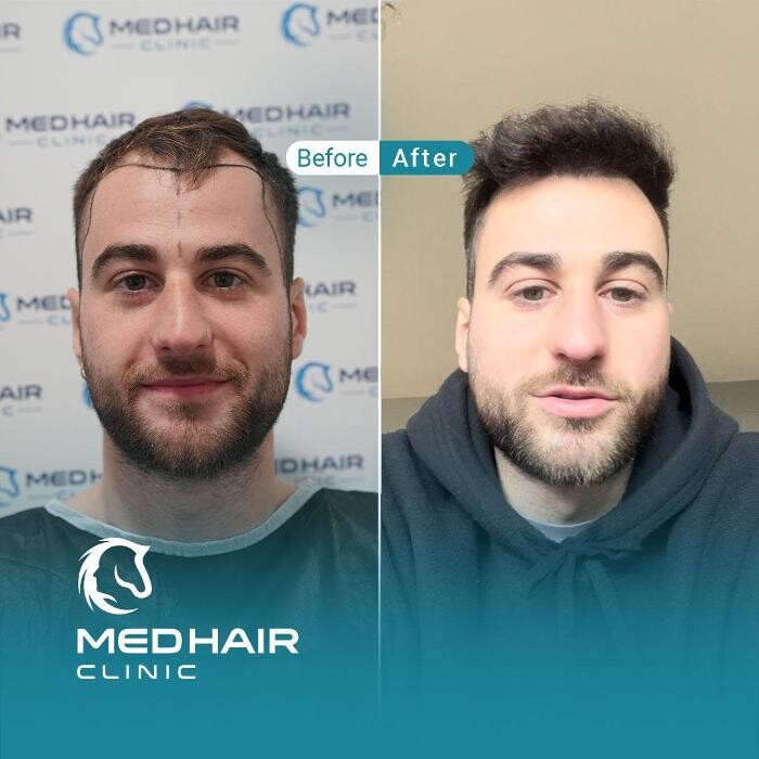 Images MedHair Clinic