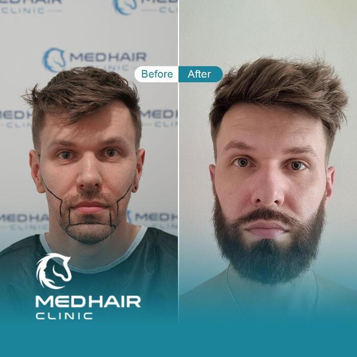 Images MedHair Clinic