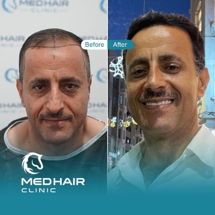 Images MedHair Clinic