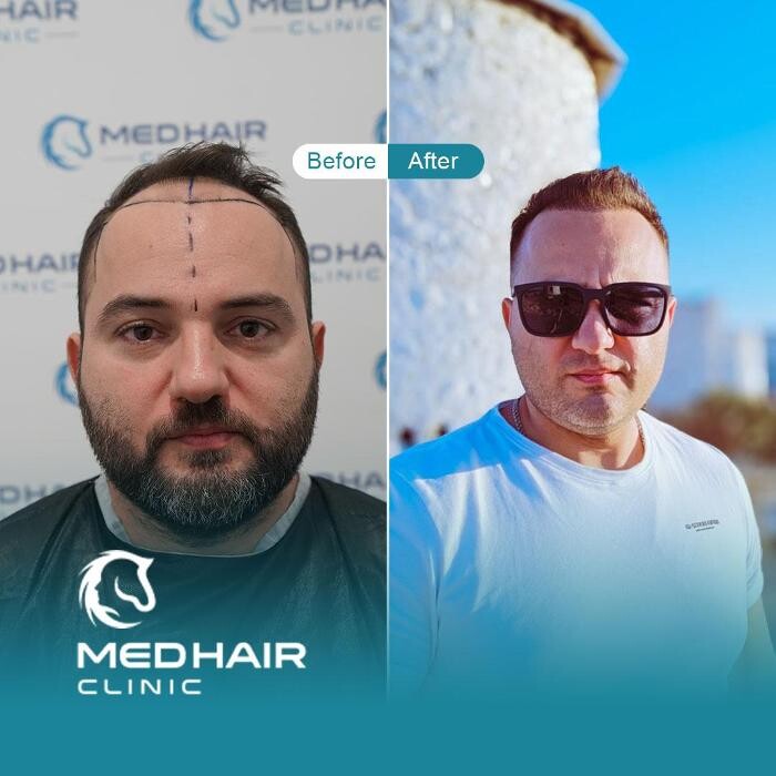 Images MedHair Clinic