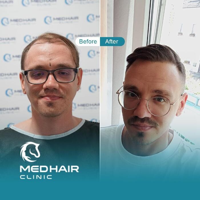 Images MedHair Clinic