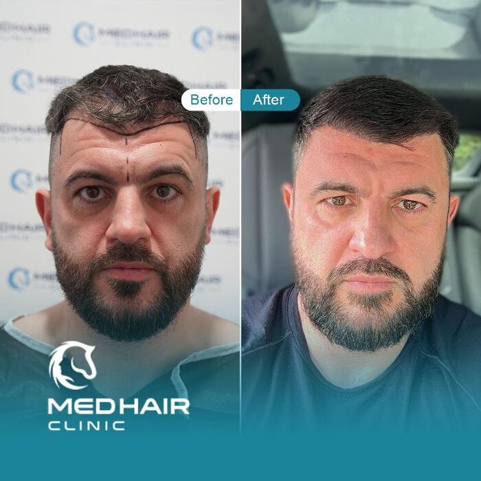 Images MedHair Clinic