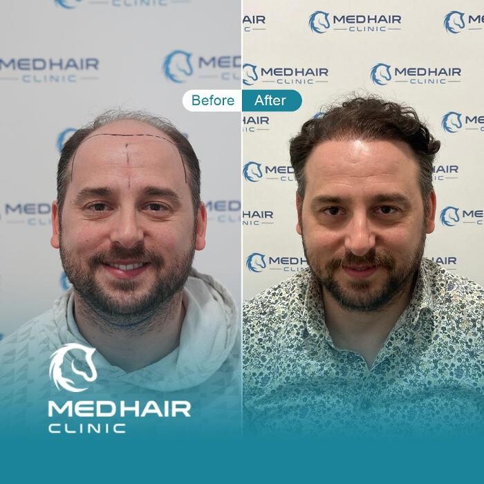 Images MedHair Clinic