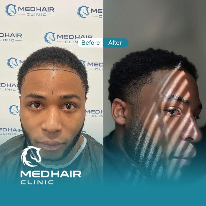 Images MedHair Clinic