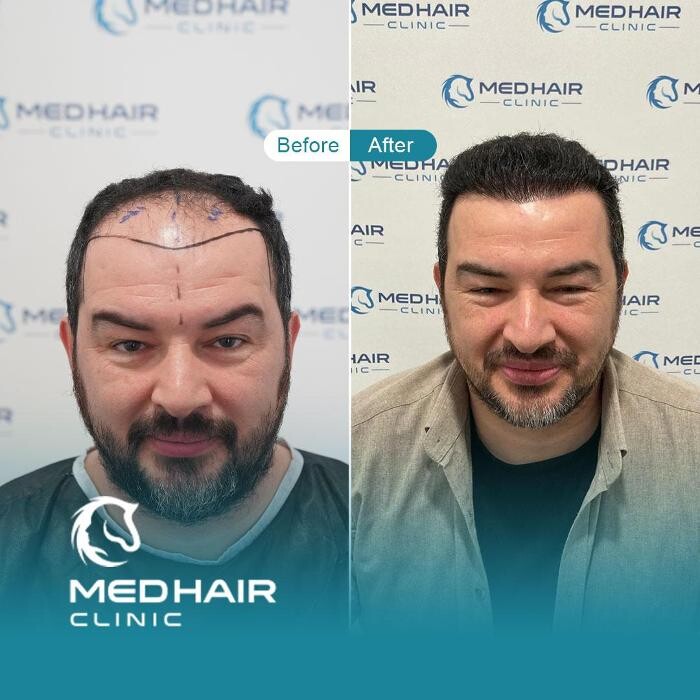 Images MedHair Clinic