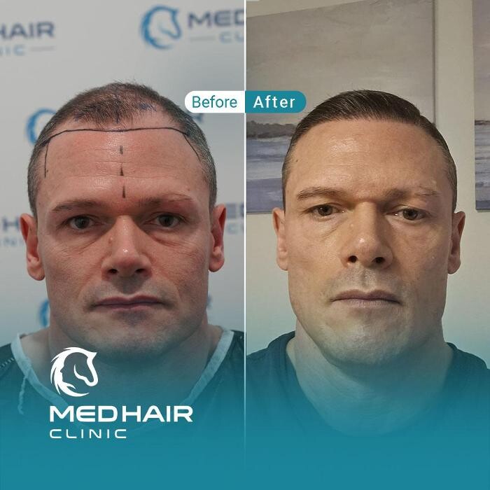 Images MedHair Clinic