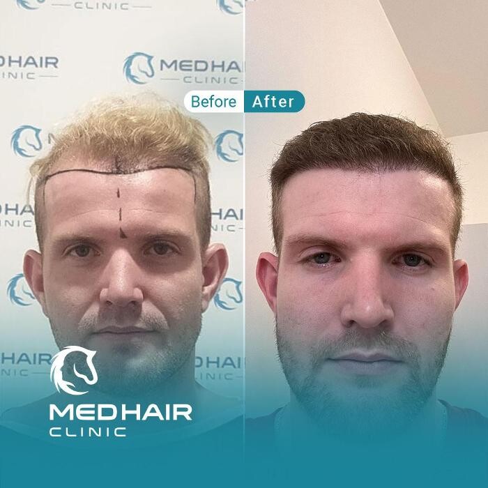 Images MedHair Clinic