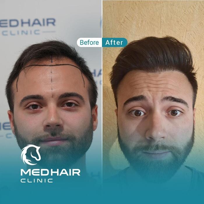 Images MedHair Clinic