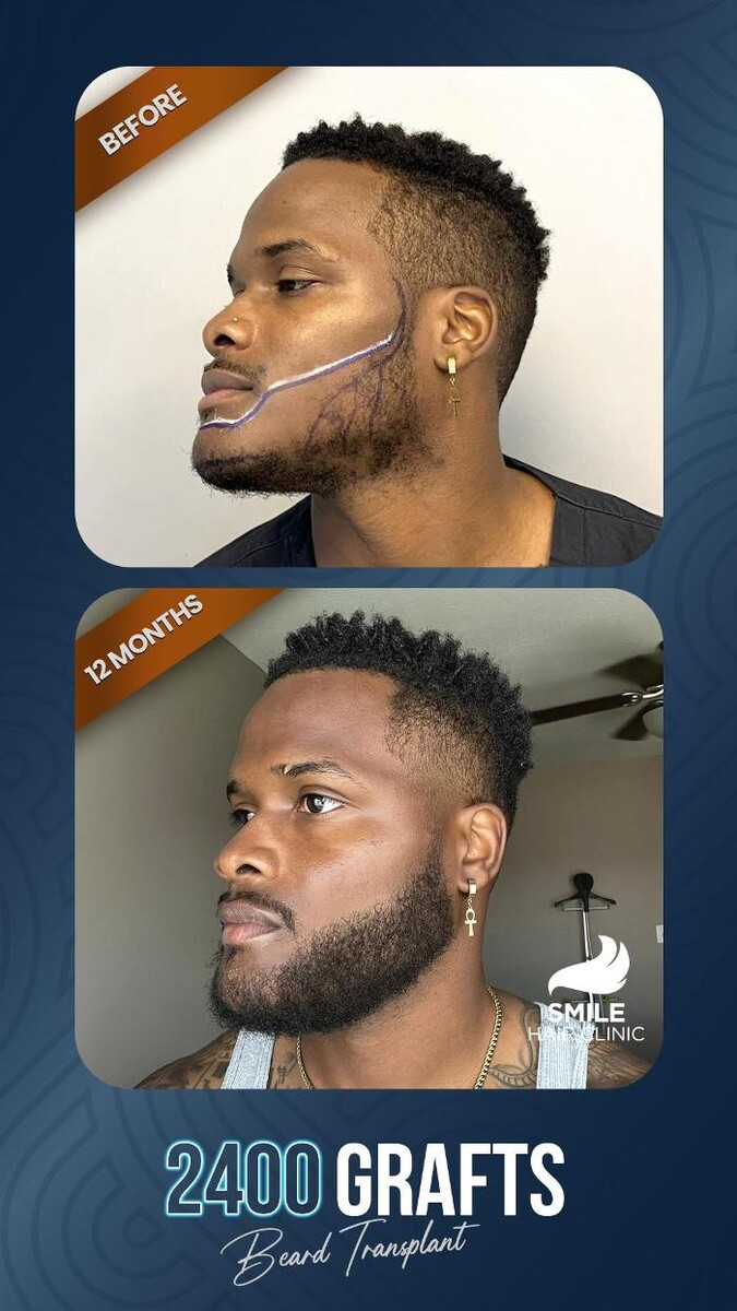 Images Smile Hair Transplant Clinic Turkey Istanbul