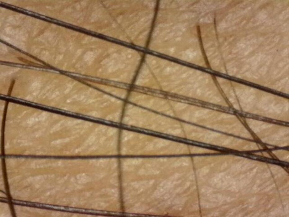 Images Esin Orhan Güzellik Merkezi - Isparta Güzellik Salonu | Isparta Lazer Epilasyon | Isparta Cilt Bakımı