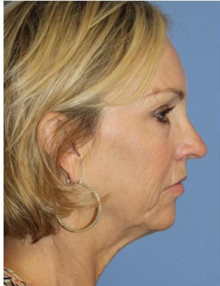 Images Klinik Europe AS l Plastic Surgery