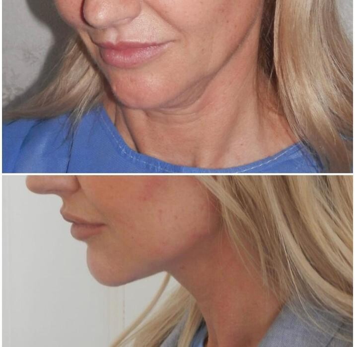 Images Klinik Europe AS l Plastic Surgery