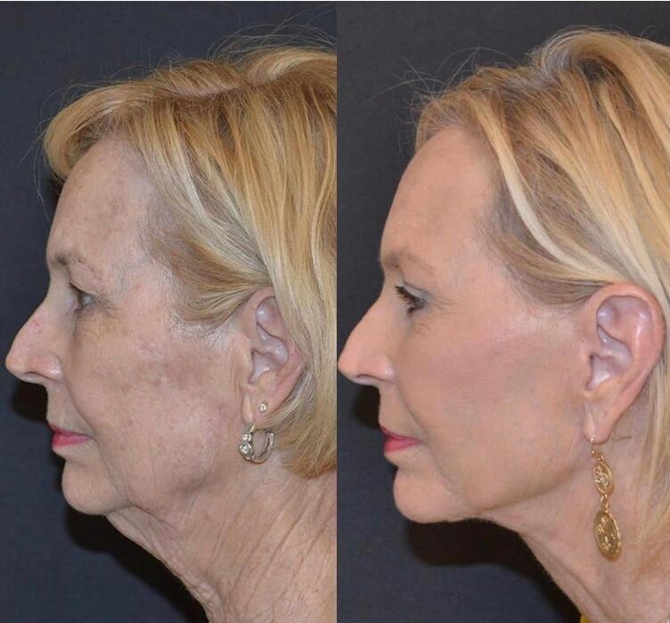 Images Klinik Europe AS l Plastic Surgery