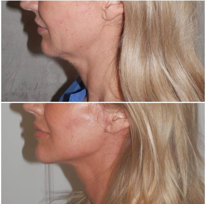 Images Klinik Europe AS l Plastic Surgery