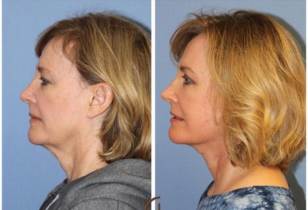 Images Klinik Europe AS l Plastic Surgery