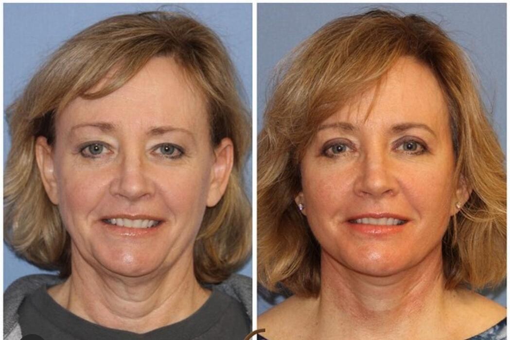 Images Klinik Europe AS l Plastic Surgery