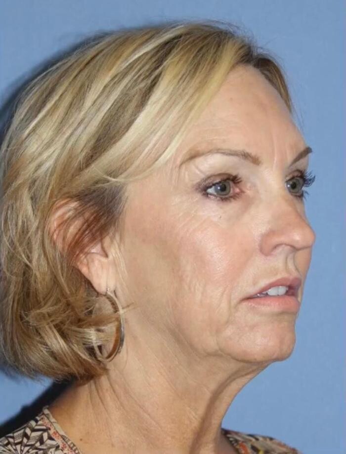 Images Klinik Europe AS l Plastic Surgery