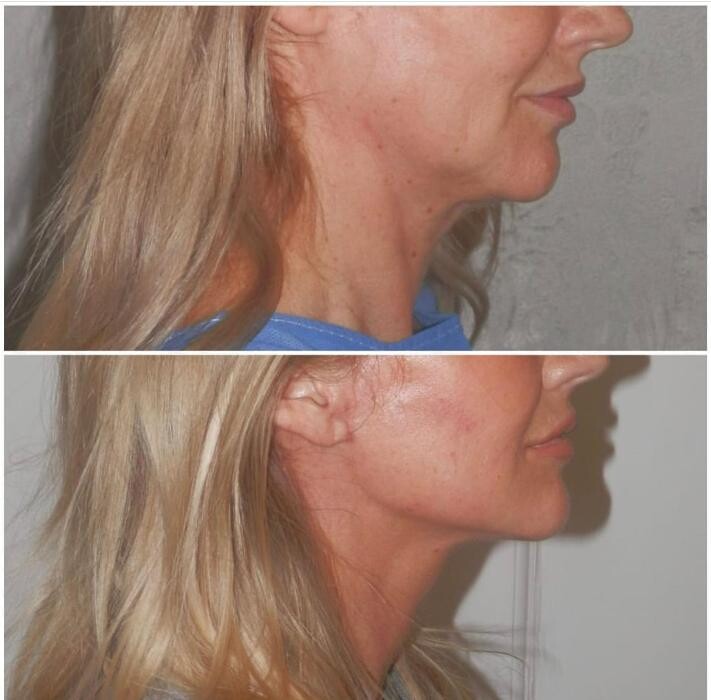 Images Klinik Europe AS l Plastic Surgery