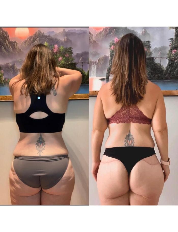 Images Klinik Europe AS l Plastic Surgery