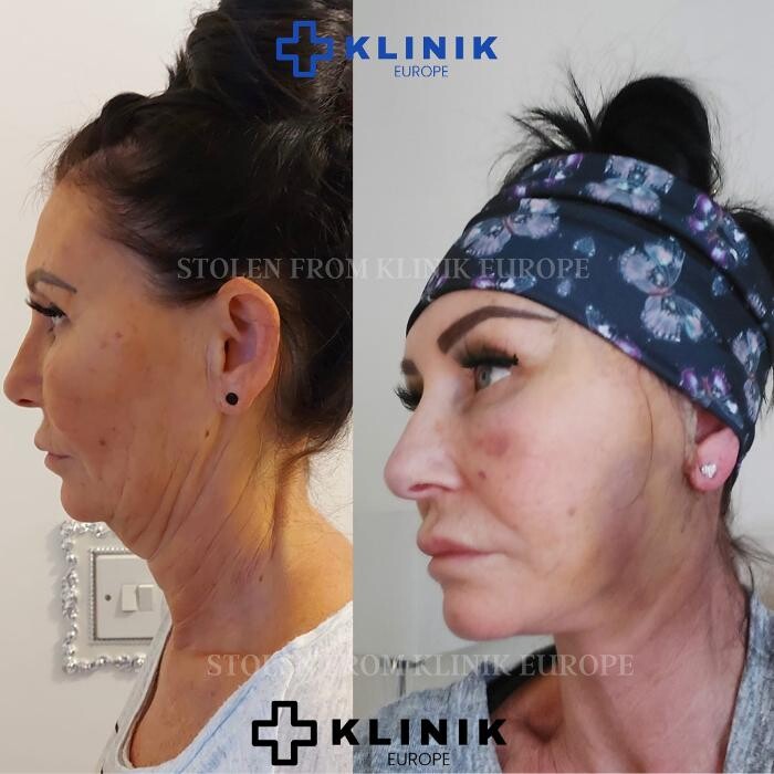 Images Klinik Europe AS l Plastic Surgery