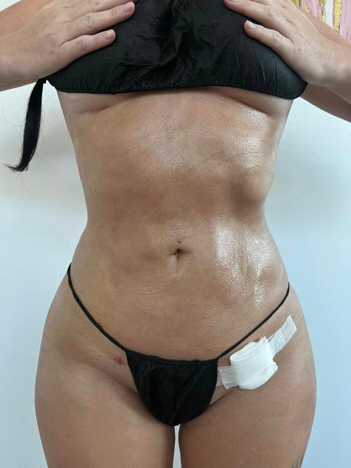 Images Klinik Europe AS l Plastic Surgery