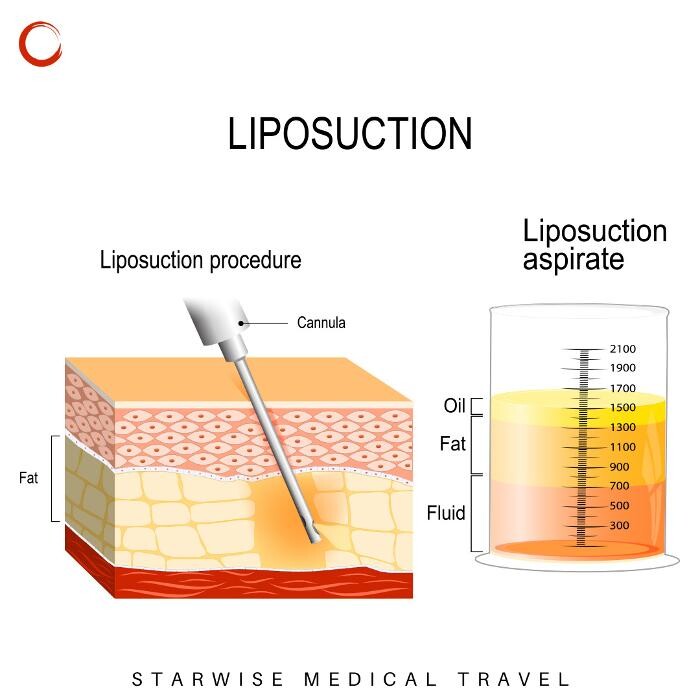 Images Starwise Medical Travel