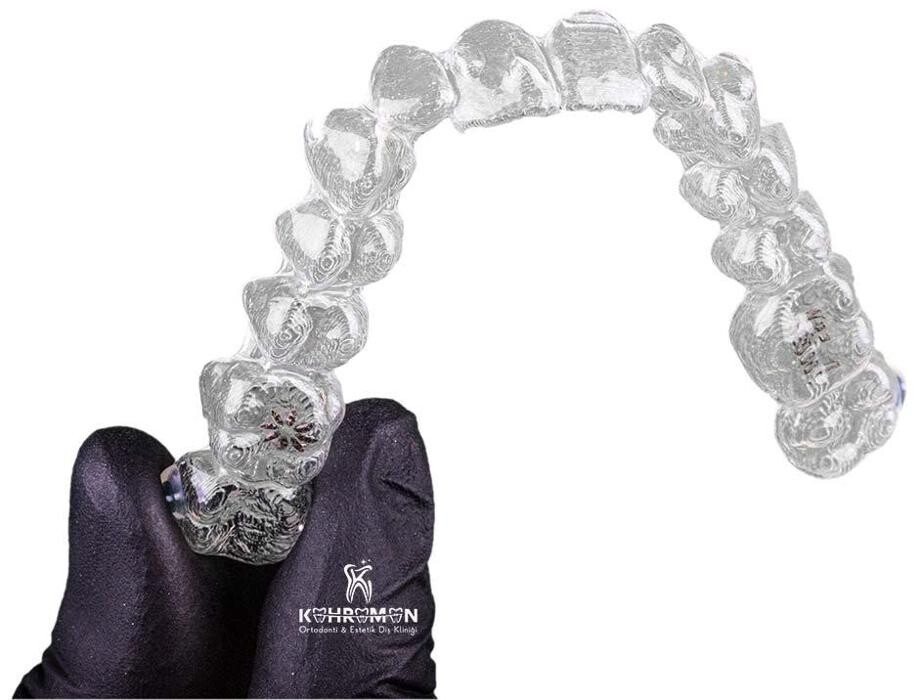 Images DentMax İstanbul Ağız ve Diş Sağlığı Polikliniği / invisalign - implant - lamine