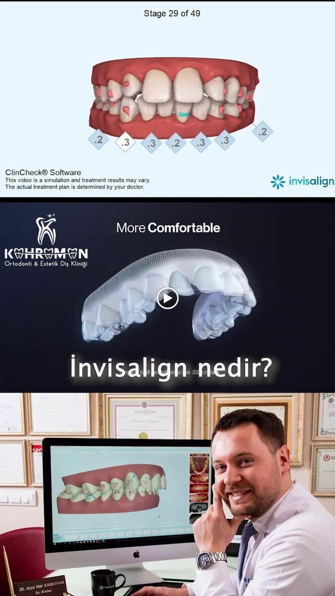 Images DentMax İstanbul Ağız ve Diş Sağlığı Polikliniği / invisalign - implant - lamine