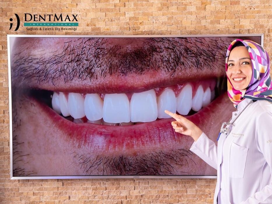 Images DentMax İstanbul Ağız ve Diş Sağlığı Polikliniği / invisalign - implant - lamine