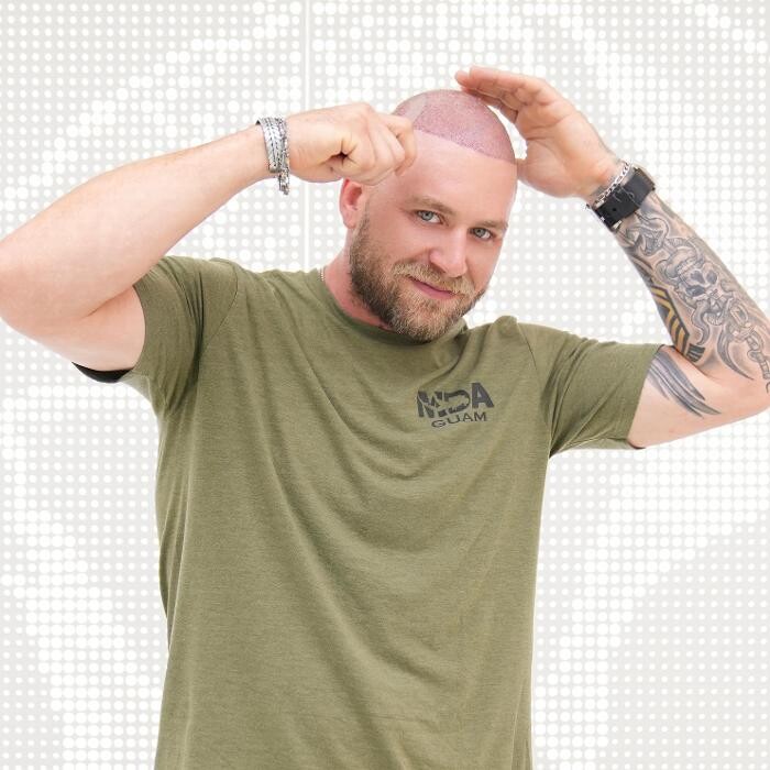 Images Hair of Istanbul | Hair Transplant Clinic