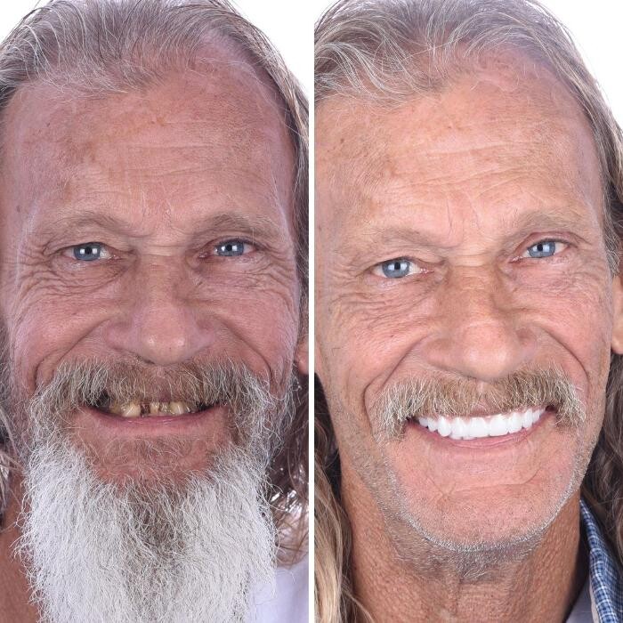 Images Britely Dentures + Implants Studio