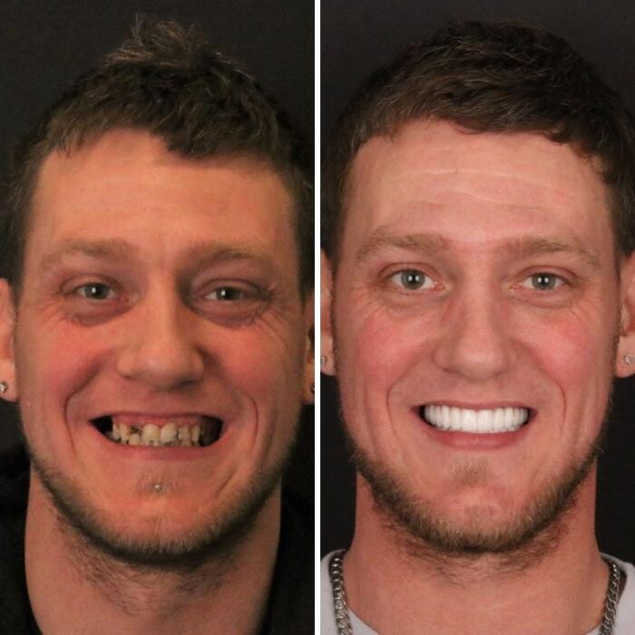 Images Britely Dentures + Implants Studio