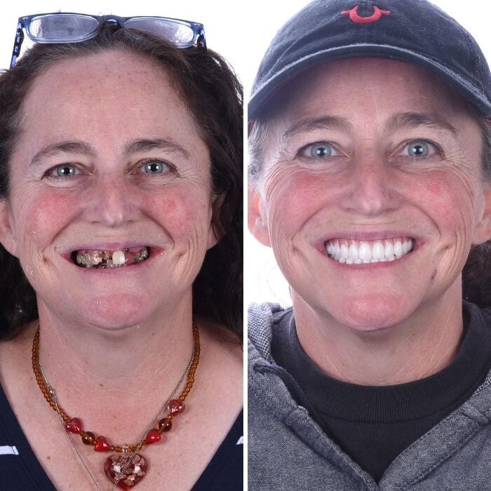 Images Britely Dentures + Implants Studio
