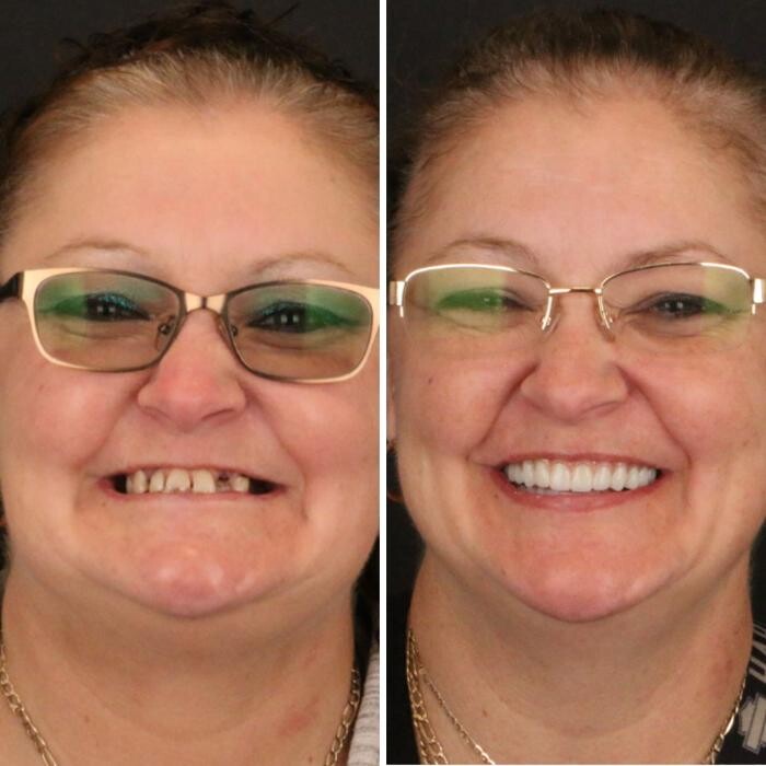 Images Britely Dentures + Implants Studio