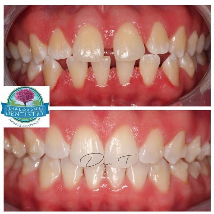 Images Flawless Smile Dentistry Broken Arrow