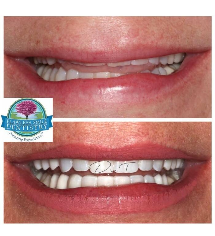Images Flawless Smile Dentistry Broken Arrow