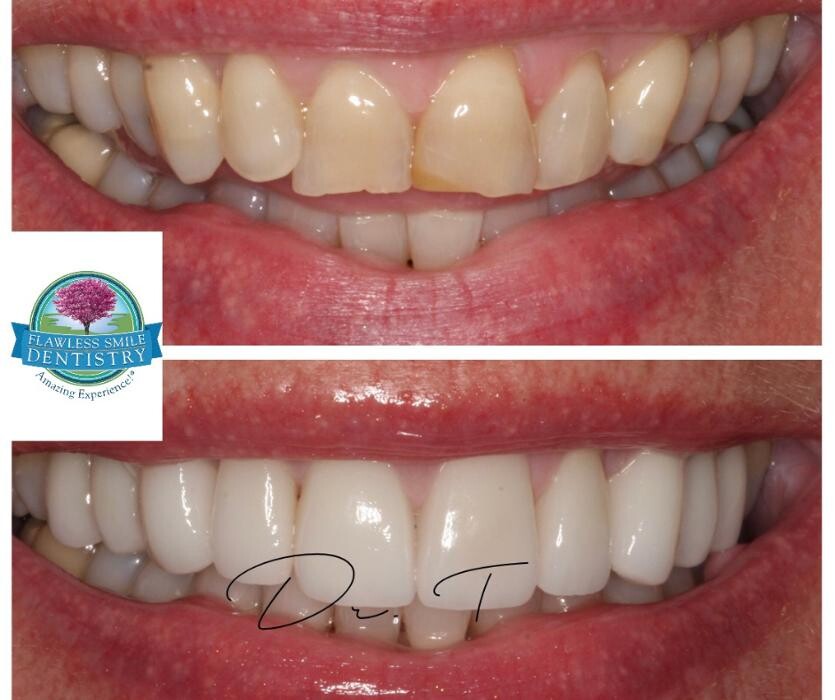 Images Flawless Smile Dentistry Broken Arrow