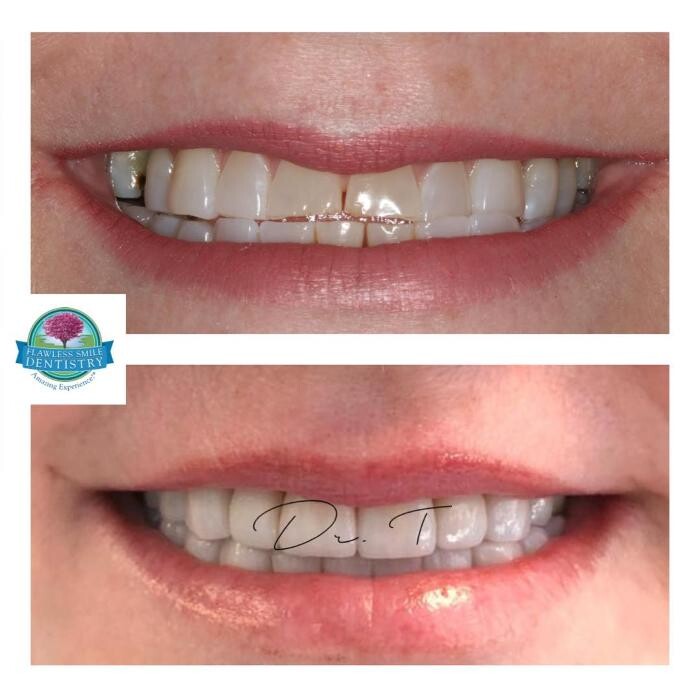 Images Flawless Smile Dentistry Broken Arrow
