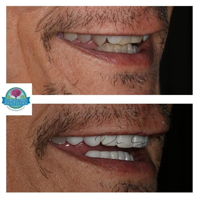 Images Flawless Smile Dentistry Broken Arrow