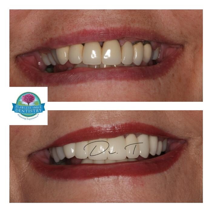 Images Flawless Smile Dentistry Broken Arrow