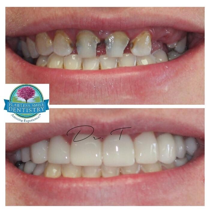 Images Flawless Smile Dentistry Broken Arrow