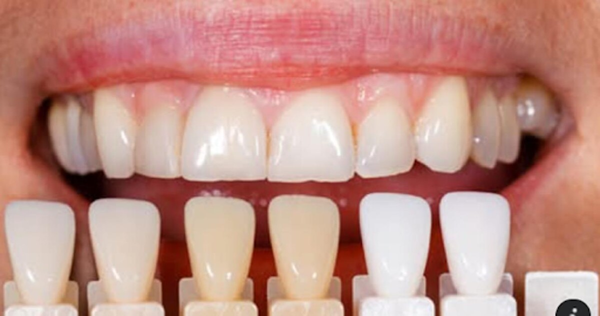 Images West Brickell Dental
